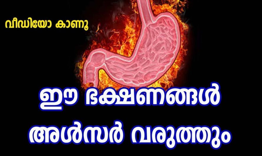 വയറിൽ അൾസർ വരുത്തുന്ന ഭക്ഷണങ്ങളെ ആരും തിരിച്ചറിയാതെ പോകല്ലേ.