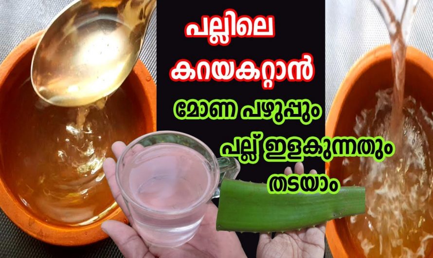 പല്ലുകൾ നേരിടുന്ന പ്രശ്നങ്ങളെ മറികടക്കാൻ ഇതിലും നല്ലൊരു മാർഗം വേറെയില്ല. ഇതാരും കാണാതെ പോകല്ലേ…| Dental Infection Natural Remedy