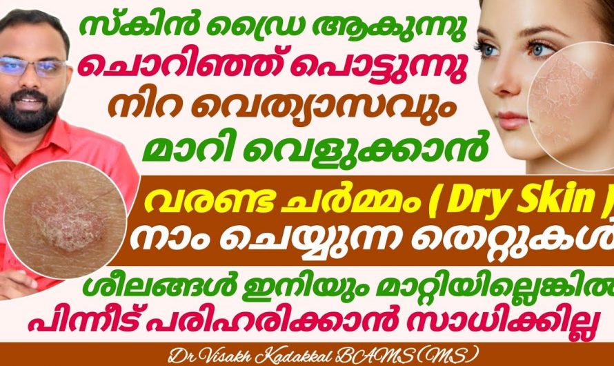 വരണ്ട ചർമ്മം ഉണ്ടാകുന്നതിന്റെ പിന്നിലുള്ള ഇത്തരം കാരണങ്ങളെ ആരും തിരിച്ചറിയാതെ പോകല്ലേ.