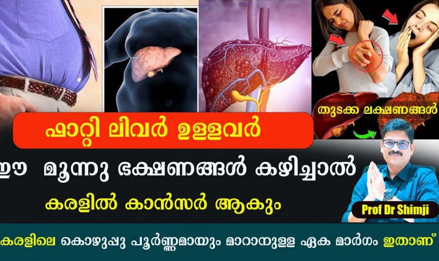 ഫാറ്റി ലിവർ ഉള്ളവർ ഉറപ്പായും ഒഴിവാക്കേണ്ട ഭക്ഷണങ്ങളെ കുറിച്ച് ആരും അറിയാതെ പോകല്ലേ.