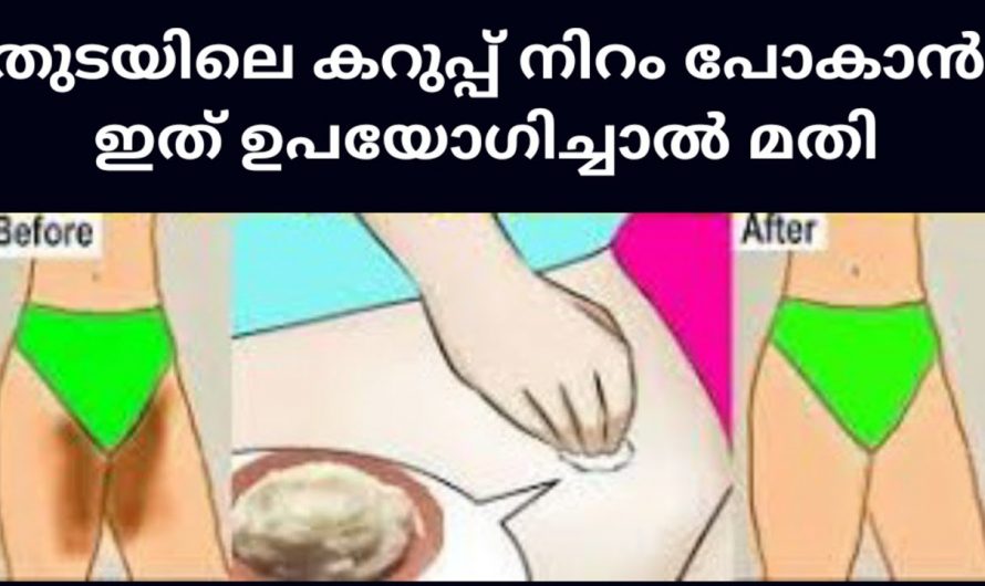 സ്വകാര്യ ഭാഗങ്ങളിലെ കറുപ്പിൽ ഇനി ആകുലരാകേണ്ട. ഇതൊരു പ്രാവശ്യം അപ്ലൈ ചെയ്യൂ മാറ്റം സ്വയം തിരിച്ചറിയൂ.