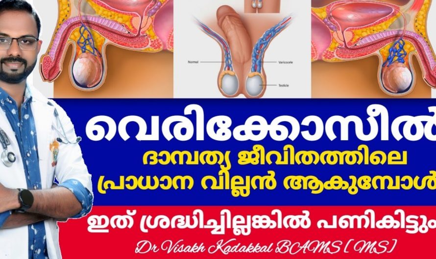 വേരിക്കോസീലിന്റെ കാരണങ്ങളെയും പരിഹാരമാർഗ്ഗങ്ങളെയും ആരും കാണാതെ പോകരുതേ.