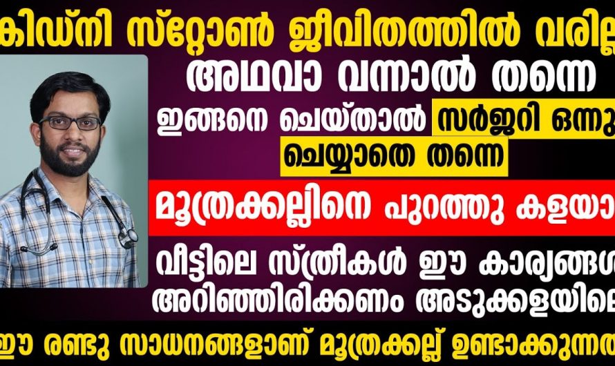 സർജറി ഇല്ലാതെ തന്നെ കിഡ്നി സ്റ്റോണിനെ മറികടക്കാo. ഇതാരും കാണാതെ പോകരുതേ.