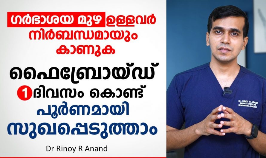 ഗർഭാശയ മുഴയെ മറികടക്കാം സർജറിയില്ലാതെ തന്നെ. ഇതാരും നിസ്സാരമായി തള്ളിക്കളയരുതേ.