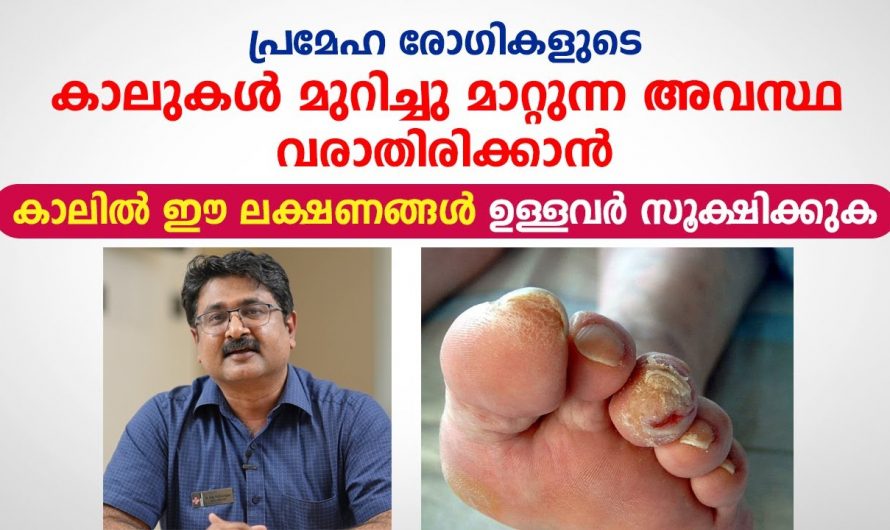 അനിയന്ത്രിതമായ ഷുഗർ മൂലം ബുദ്ധിമുട്ടുന്നവരാണോ നിങ്ങൾ?  എങ്കിൽ ഇതാരും തിരിച്ചറിയാതെ പോകല്ലേ.