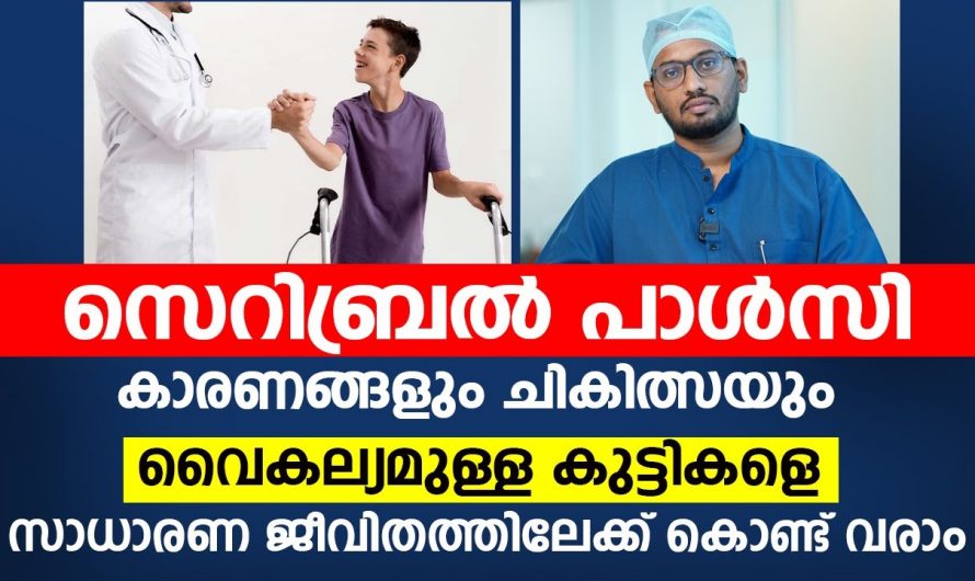 സെറിബ്രൽ പാൾസിയുടെ യഥാർത്ഥ കാരണങ്ങളെ ആരും തിരിച്ചറിയാതെ പോകരുതേ…| Cerebral Palsy Treatment