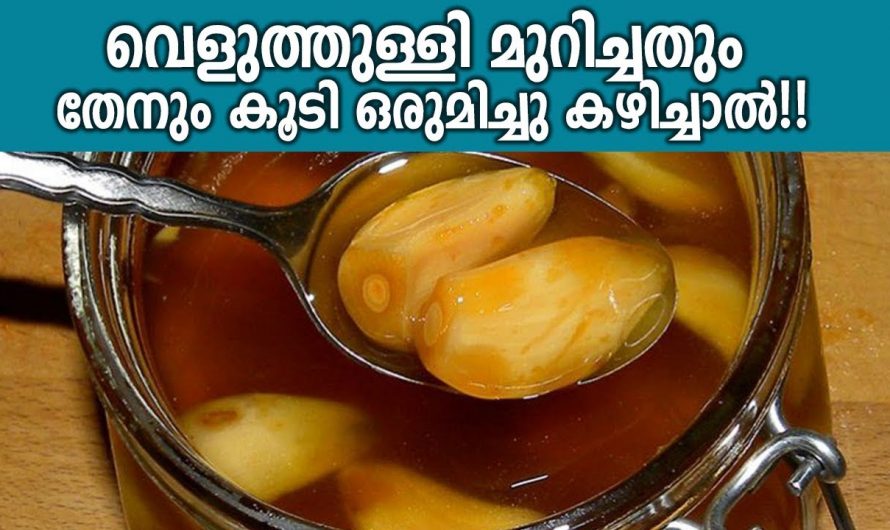 കൊളസ്ട്രോൾ ഷുഗർ ബിപി എന്നിവയെ കുറയ്ക്കാൻ ഇത് ഇങ്ങനെ കഴിക്കൂ. ഇതാരും കാണാതെ പോകല്ലേ…| Garlic and honey benefits