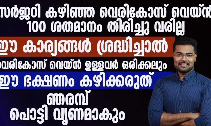 വെരിക്കോസിനെ മാറ്റാൻ ഈ ഭക്ഷണം ശീലമാക്കൂ. മാറ്റം സ്വയം തിരിച്ചറിയൂ.