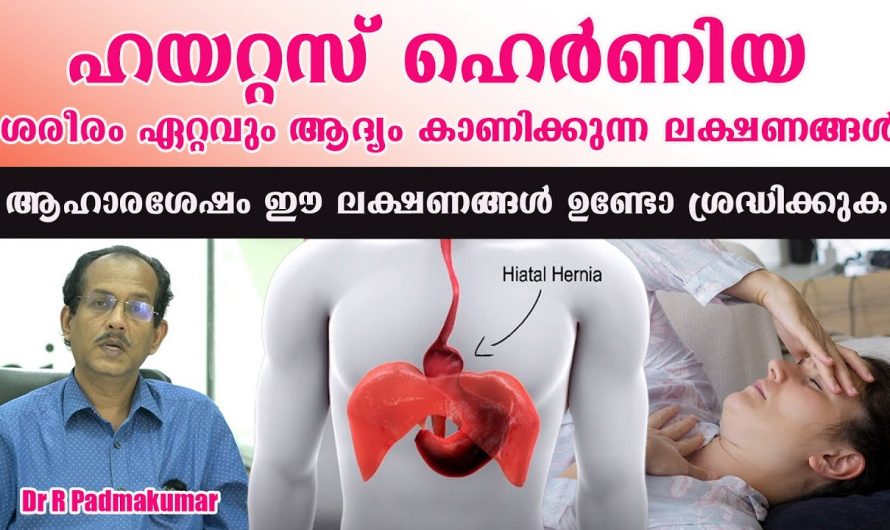 ഹയറ്റസ് ഹെർണിയയ്ക്ക് ശരീരം കാണിക്കുന്ന ഇത്തരം ലക്ഷണങ്ങളെ തിരിച്ചറിയാതെ പോകല്ലേ.