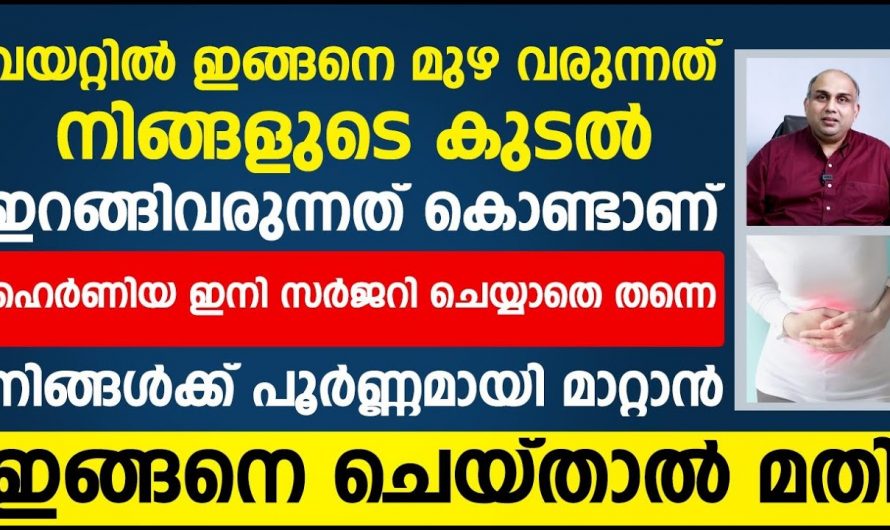 ഹെർണിയ നിങ്ങളിലെ ഒരു പ്രശ്നമാണോ?  എങ്കിൽ ഇതാരും കാണാതെ പോകല്ലേ.