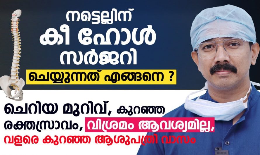 വളരെ എളുപ്പത്തിൽ നട്ടെല്ലിനെ കീഹോൾ സർജറി ചെയ്യുന്നതിനെക്കുറിച്ച് ഇതുവരെയും അറിയാതെ പോയല്ലോ…| Keyhole Spine Surgery