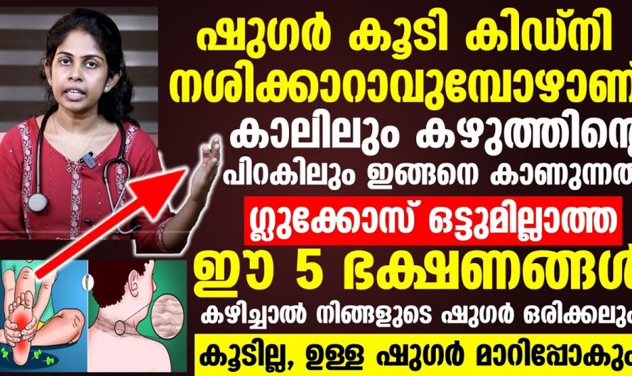 ഷുഗർ കുറയ്ക്കാൻ കഴിക്കാവുന്ന ഭക്ഷണങ്ങളെപ്പറ്റി ഇതുവരെയും അറിയാതെ പോയല്ലോ…| Sugar control food malayalam